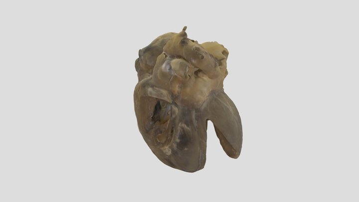 Truncus Arteriosus_A72154 3D Model