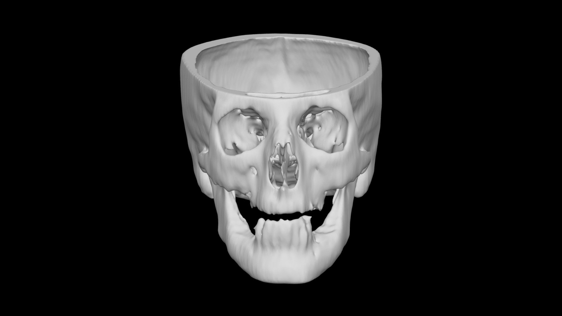 Skull Female 54yo