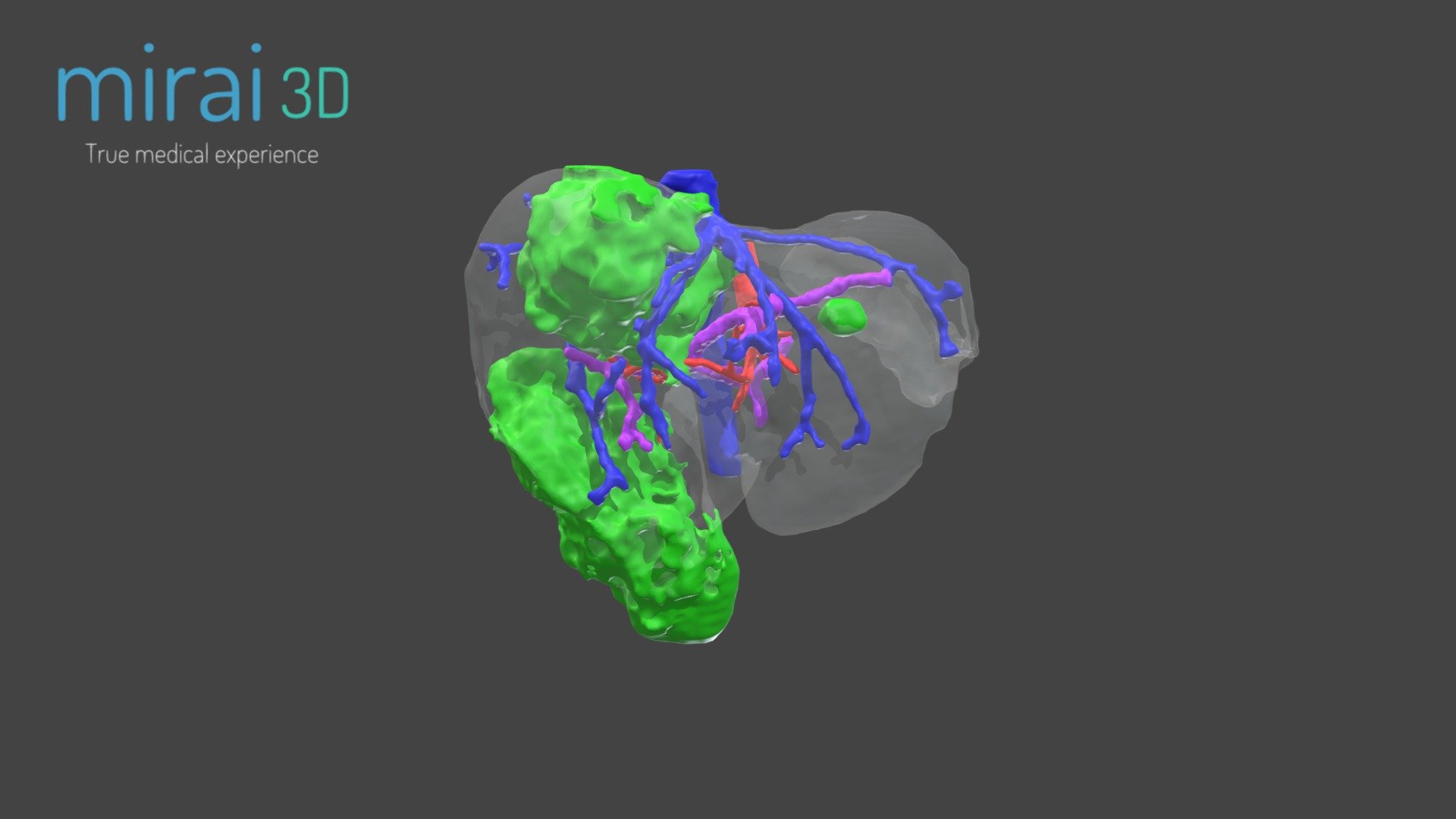 Medical Model WP69 HPB 3D model by MIRAI3D [569b0eb] Sketchfab