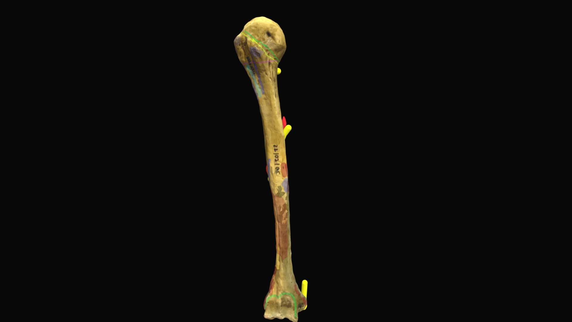 Humerus upper end and shaft