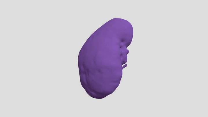 Right Kidney 3D Model