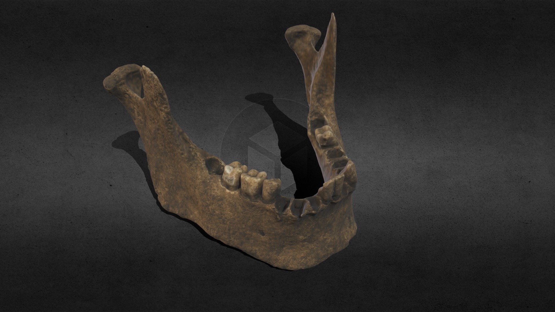 Maxilar Inferior Individuo I