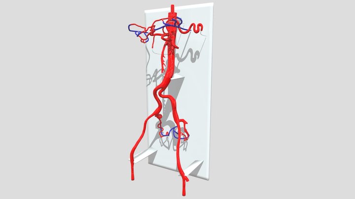 Abdominal Aorta Endovaslular Simulator 3D Model