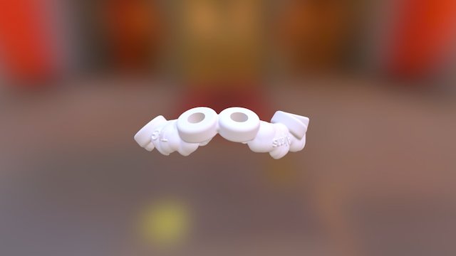 Surgical-Guide via coDiagnostiX™ 3D Model