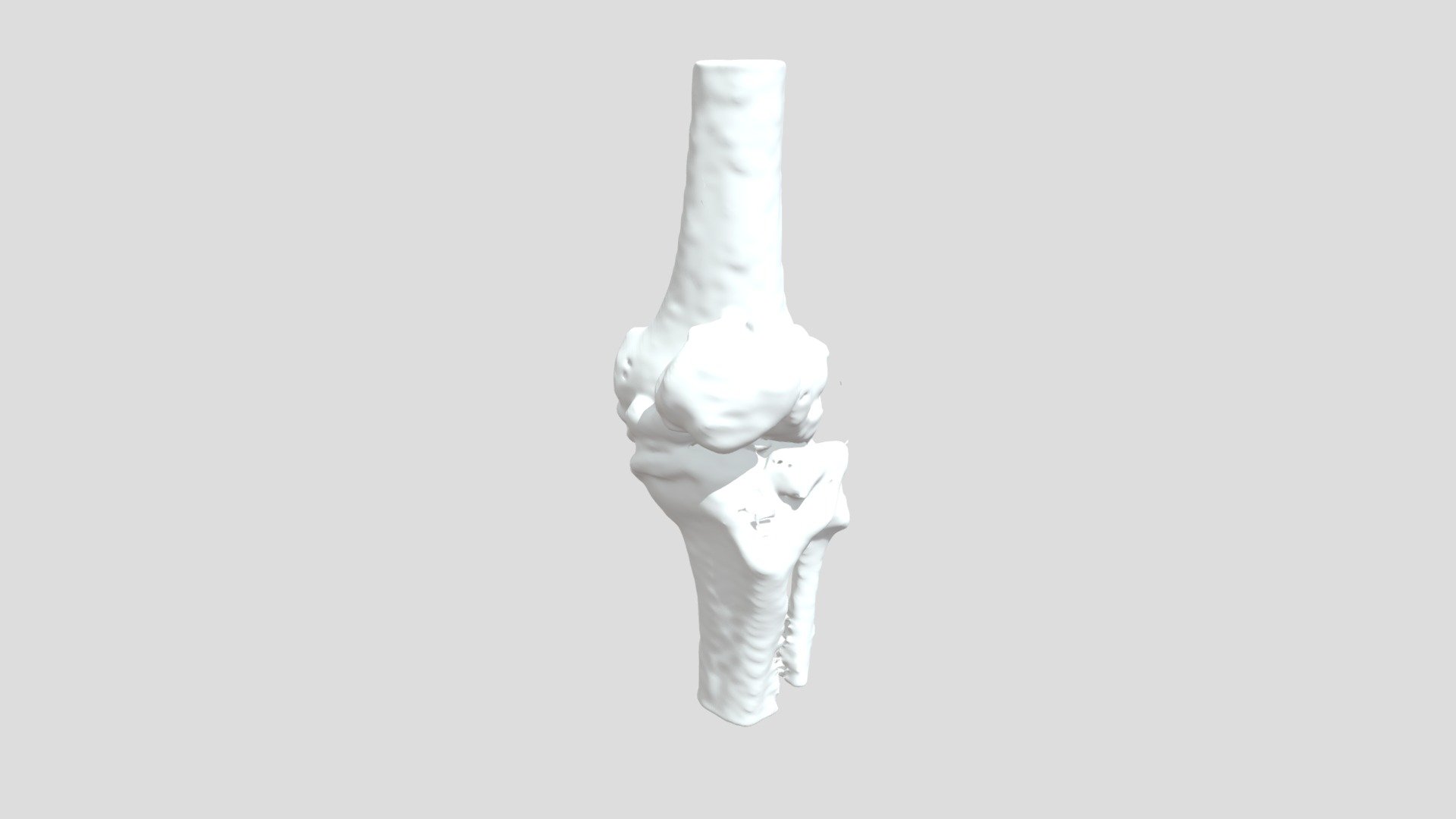 Segmentation Dprapltbone