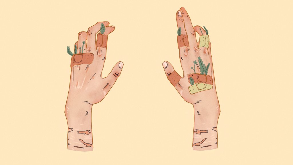 Damaged hands