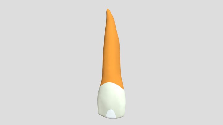 1-DENT 3D Model