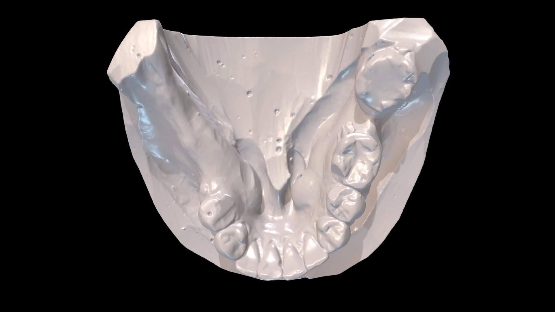 Case CC Mandibular Arch - Download Free 3D model by mdentalmargeaux ...