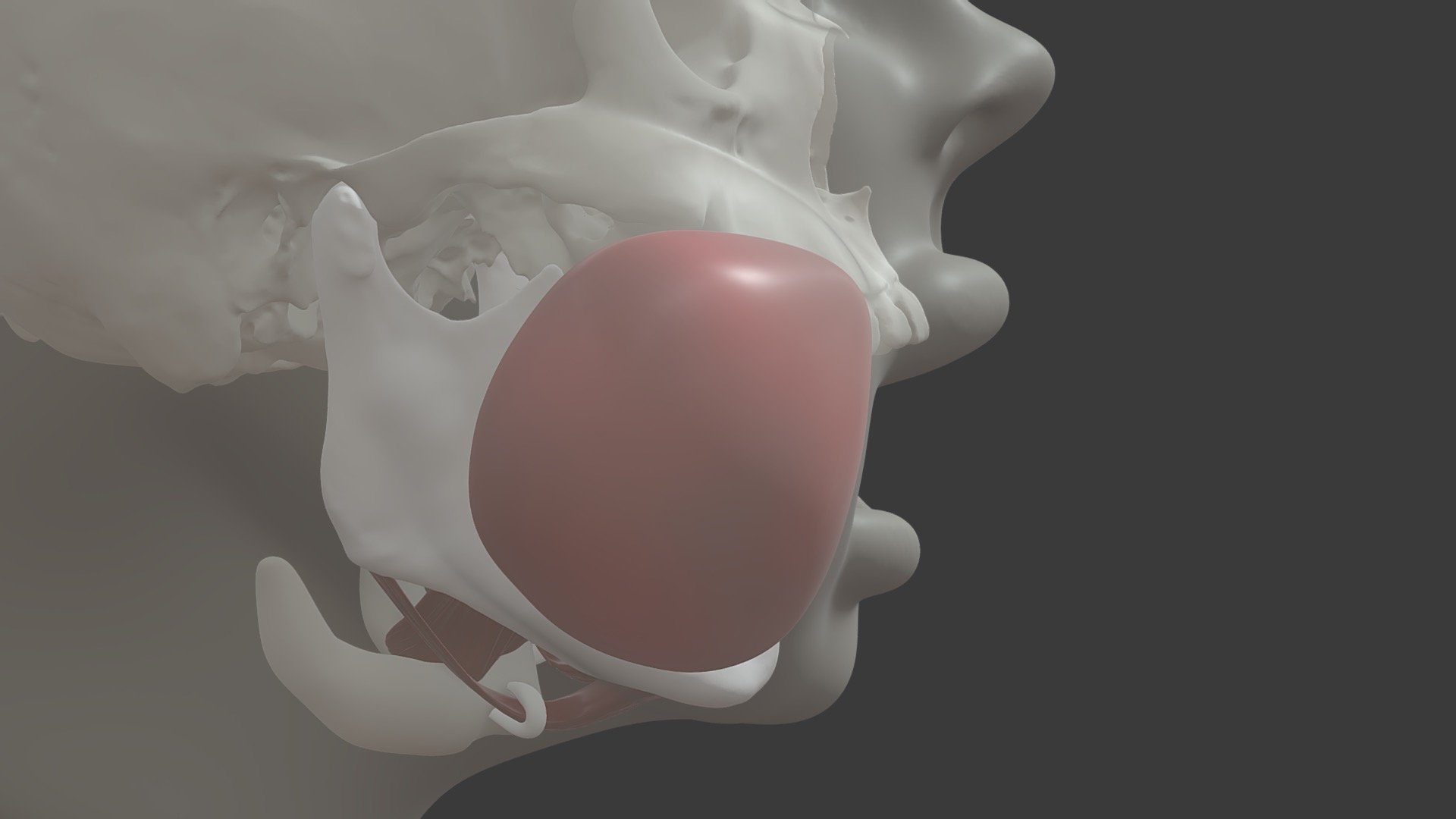 Stage 6 Mandibular Molar Infection Pathway 2 - 3D model by University ...