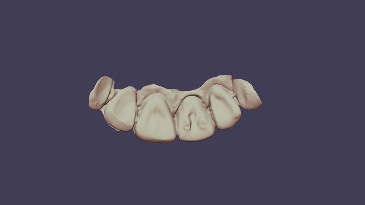 Group 16 2nd #8 Waxup Upper Jaw 3D Model
