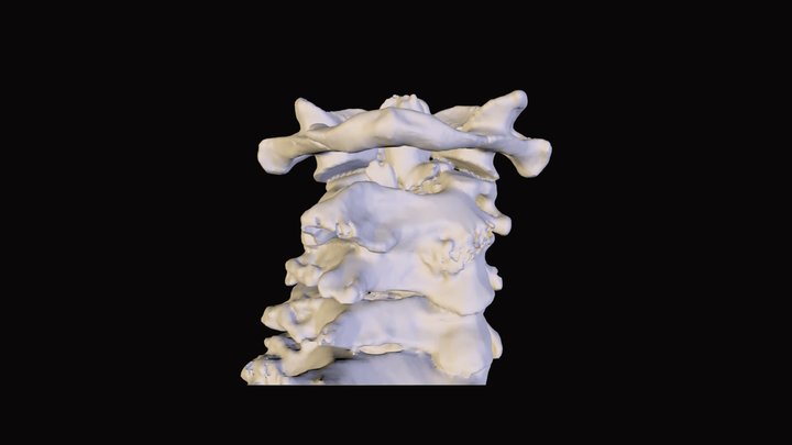 CHUZHUANZHI_Bone 2_001 3D Model