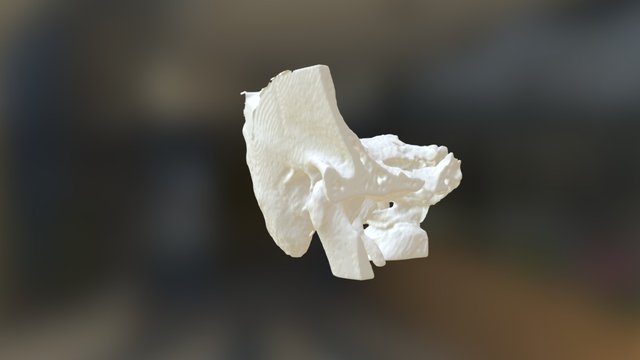 Temporal Bone 3D Model