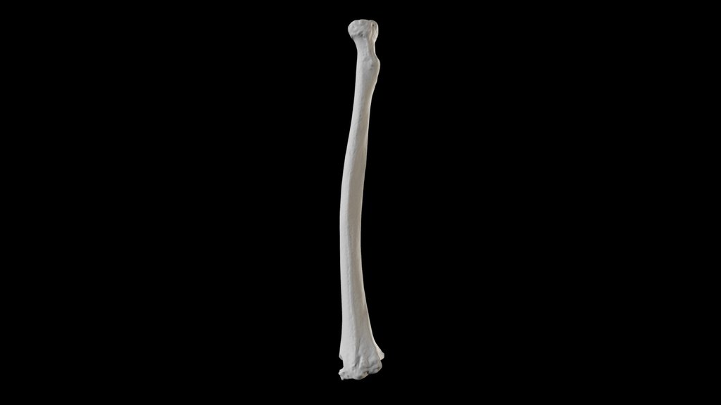 Human radius
