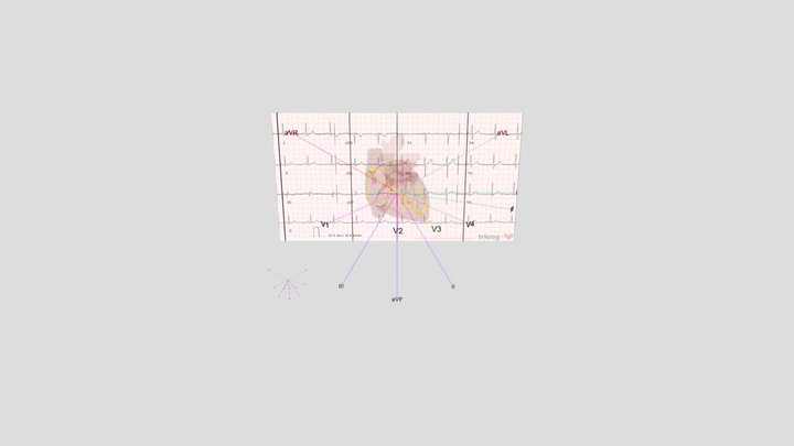 Heart conduction synced with vector & ECG 3D Model