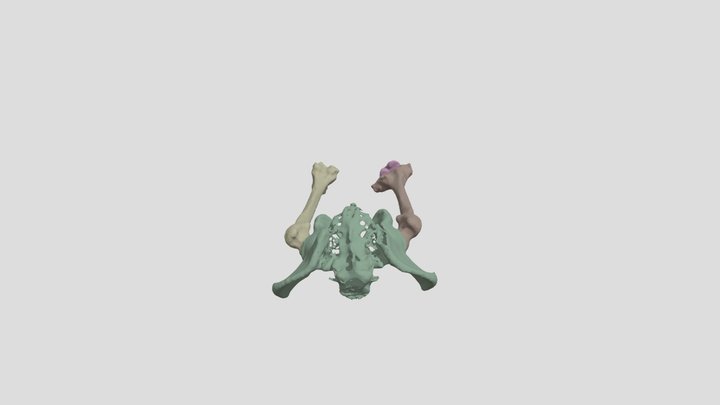 Femur Segmentation 3D Model