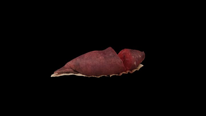 Lung Nodule 3D Model