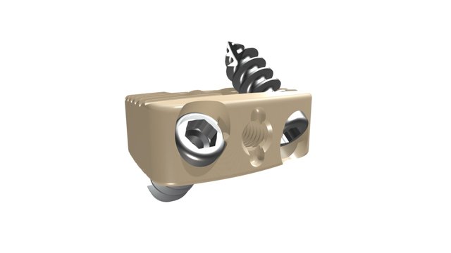 A-CIFT SoloFuse 3D Model