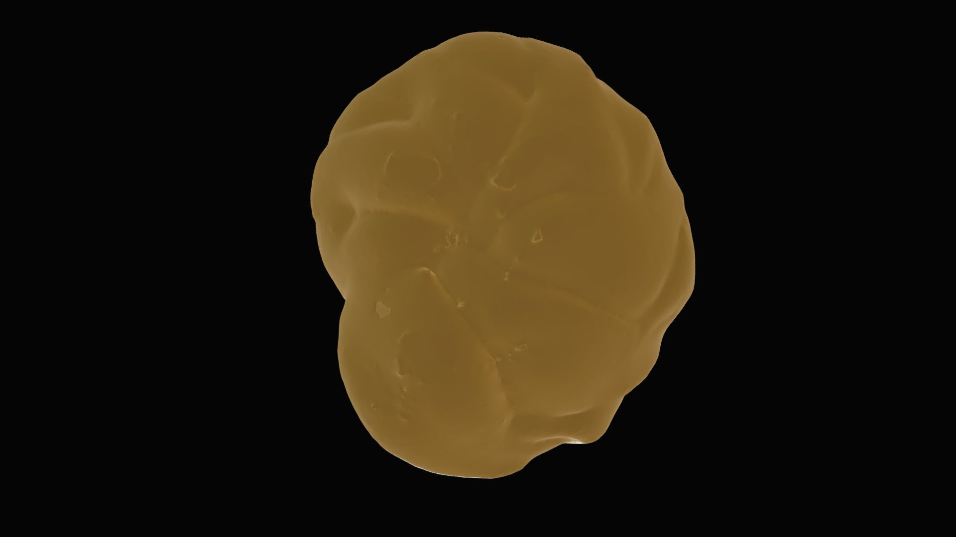 Globocassidulina