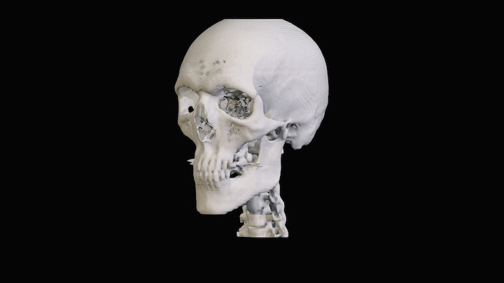 Adam's Skull - Computerized Tomography 3D Model
