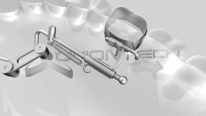UNIONTECH_X5 mesializzatore e ancoraggio 3D Model