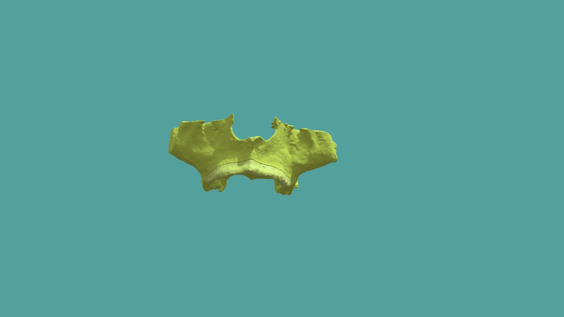 edilha - 3D model by Cirurgiaguiada.net (@leandroperussolo) [598e617 ...