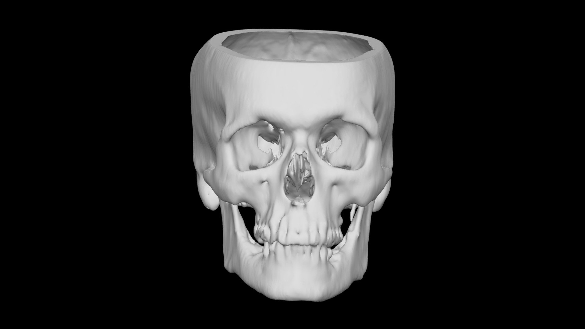Skull Male 59yo
