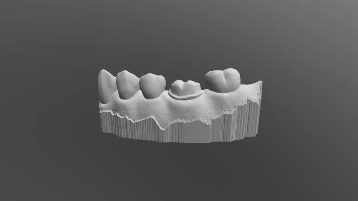 All ceramic crown prep 3D Model