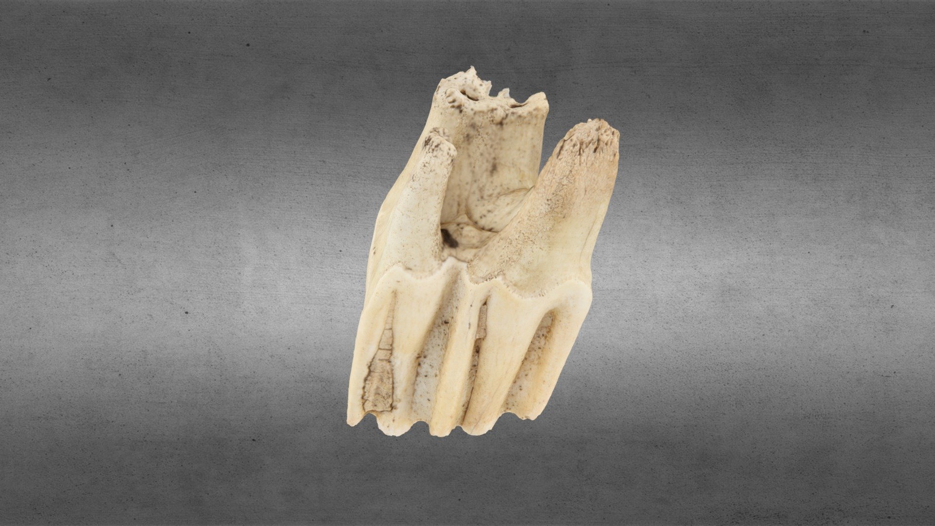 Tooth
