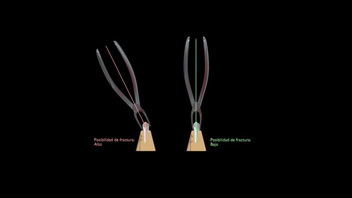 Forceps 3D models - Sketchfab