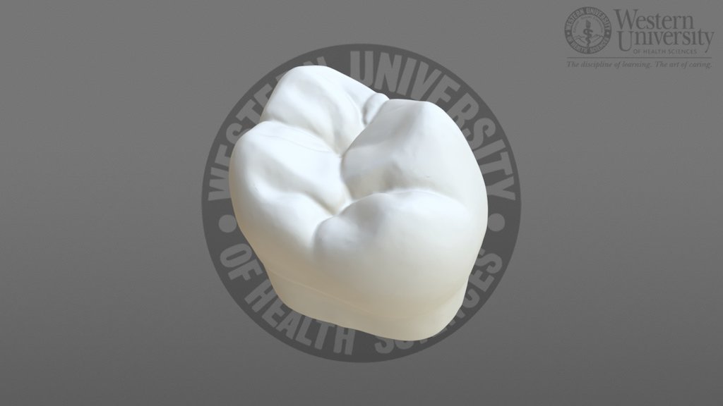 300025 Maxillary 2nd Molar