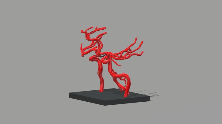 Cerebral Arterial Circle 3D Model
