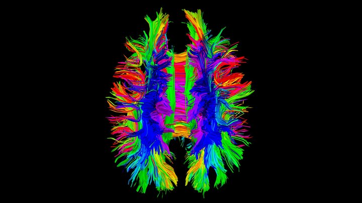 Tractography from MRI 3D Model