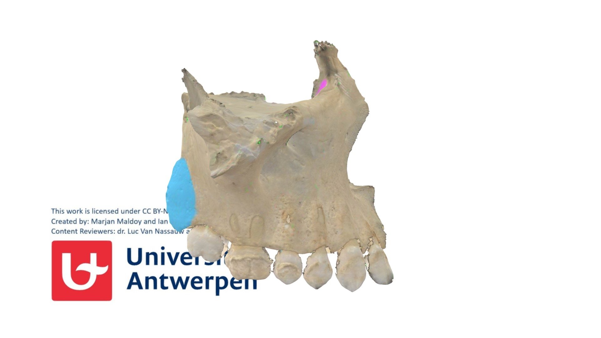 Maxilla corpus - 3D model by Universiteit Antwerpen (@marjanmaldoy ...
