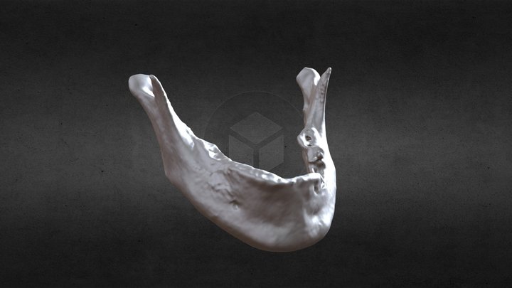 Gemes Janos Mandibule 3D Model