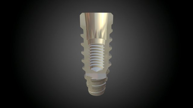 Implante 3D Model