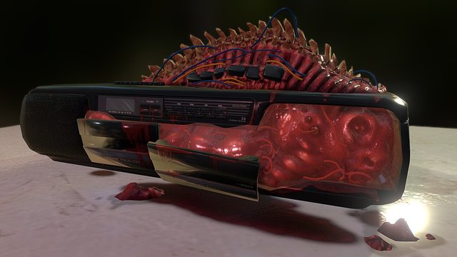 Stereo Spinal 3D Model