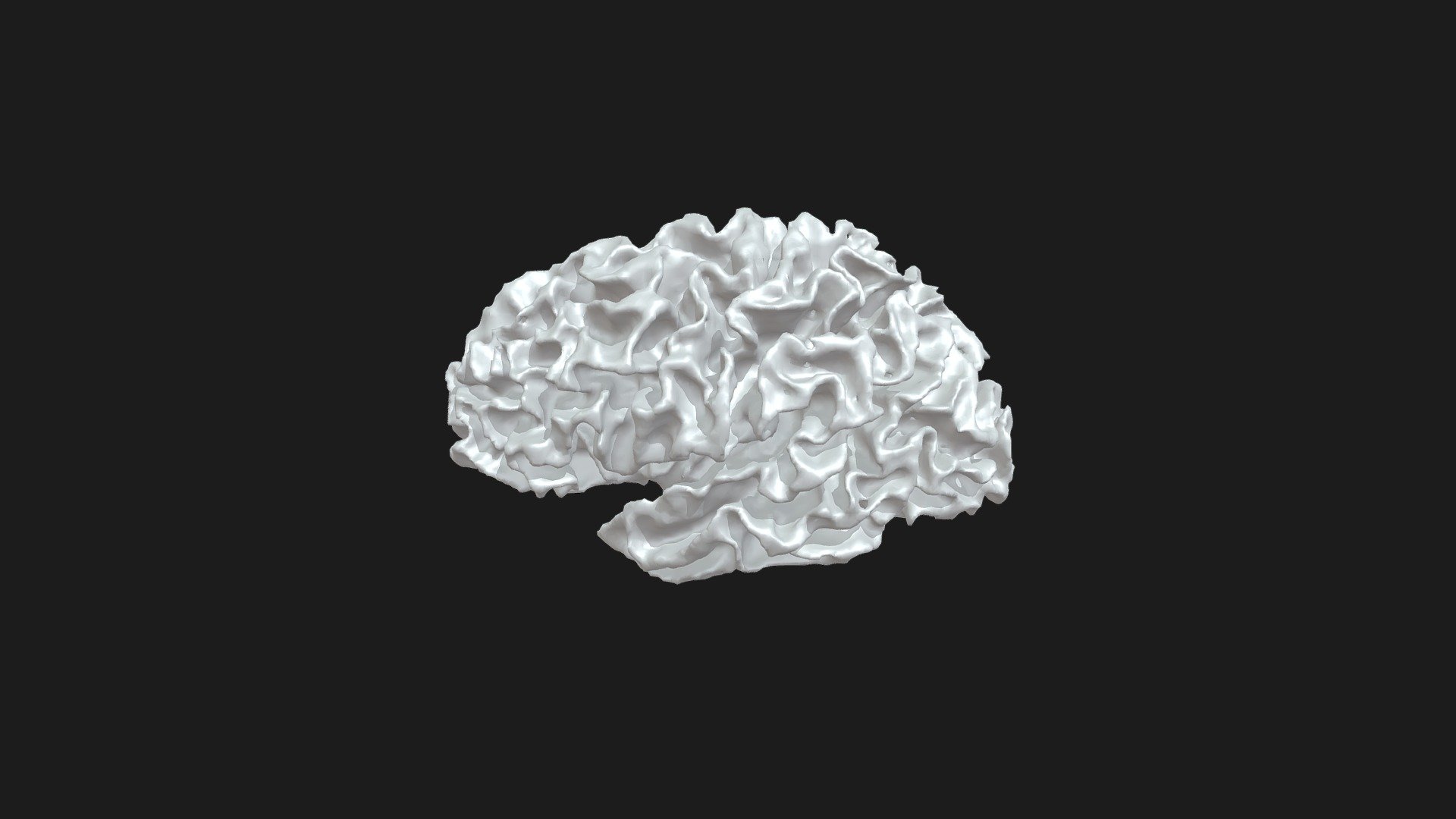 Human Brain: Hemispheric White Matter