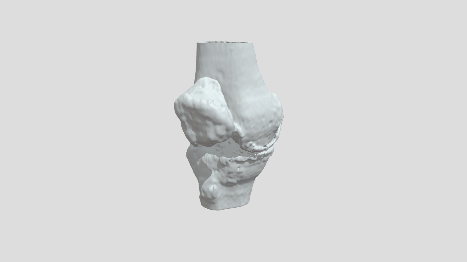 Segmentation Smortbone