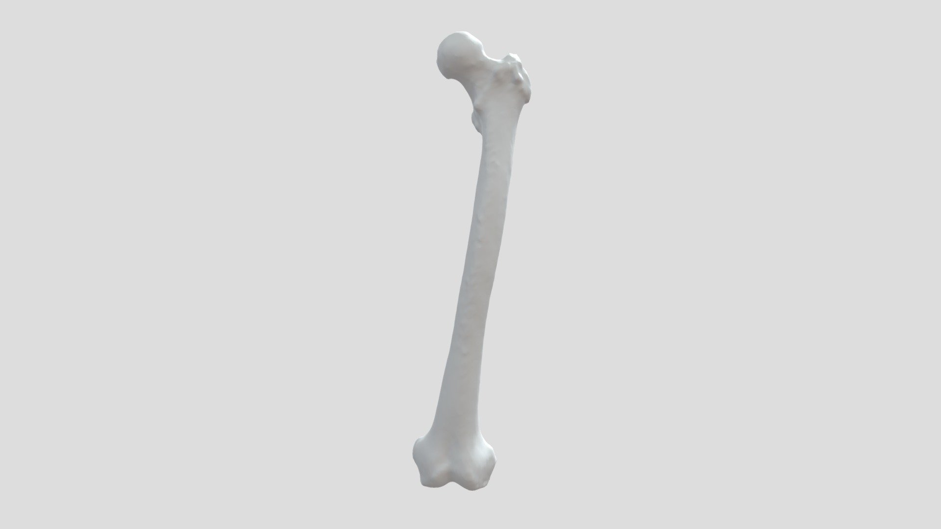Femur, Upper part annotated