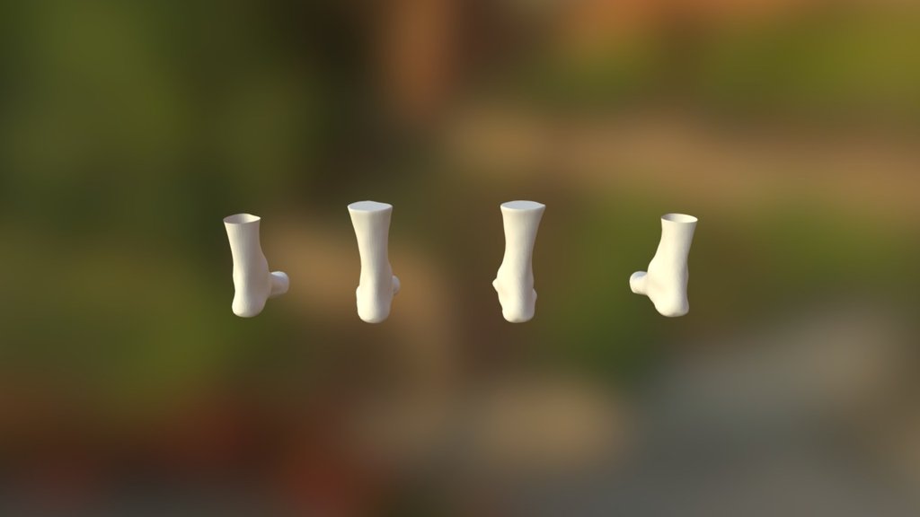 Fontanel Comp