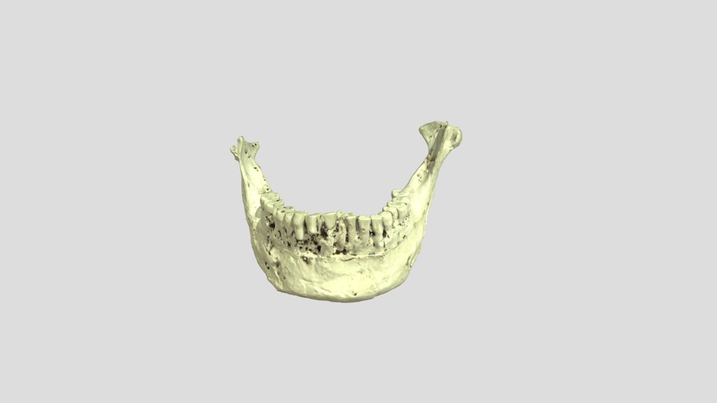 Amud-1 - Mandible