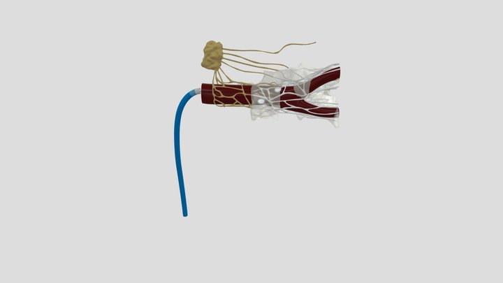 Lesion Anatomy_HTML 3D Model
