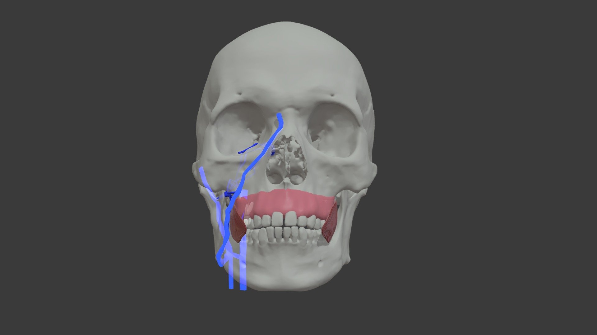 Stage 6 Long Root Maxillary Dental Infection - 3d Model By University 