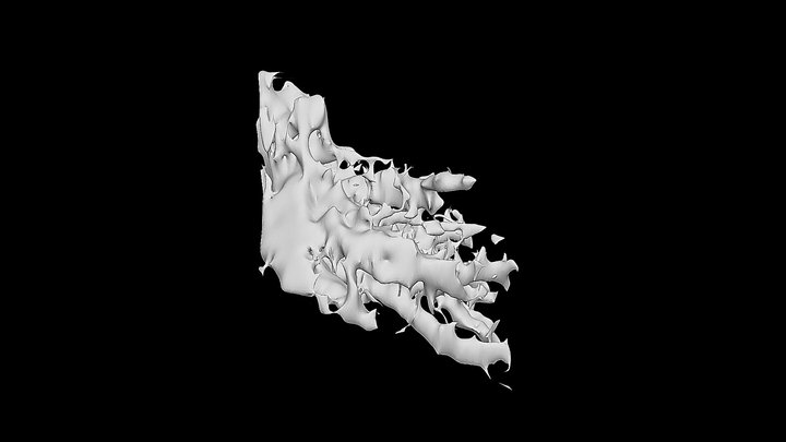 Bronchioles 3D Model