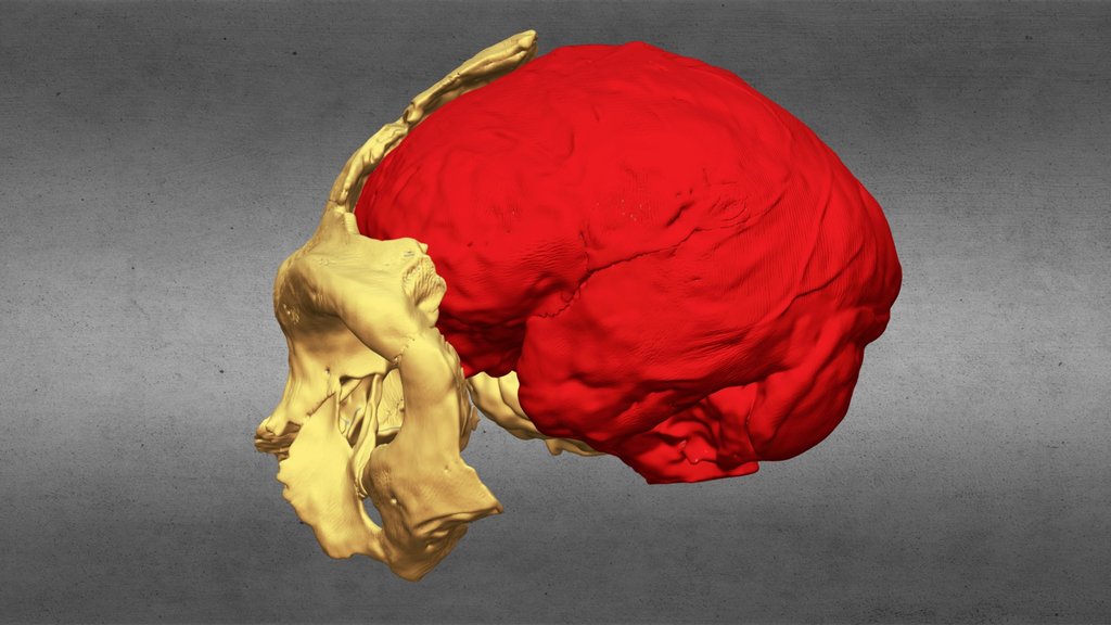 Krapina 3 Neanderthal Skull and Endocast
