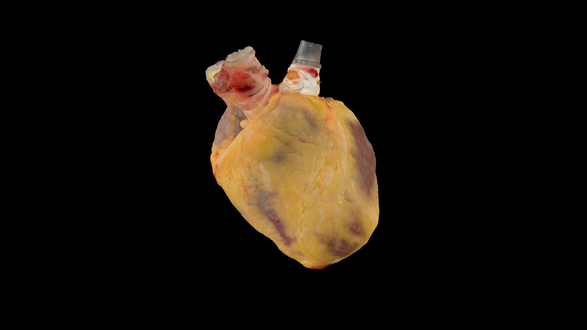 Fresh Research Human Heart #0604 — Sketchfab embed 3D viewer