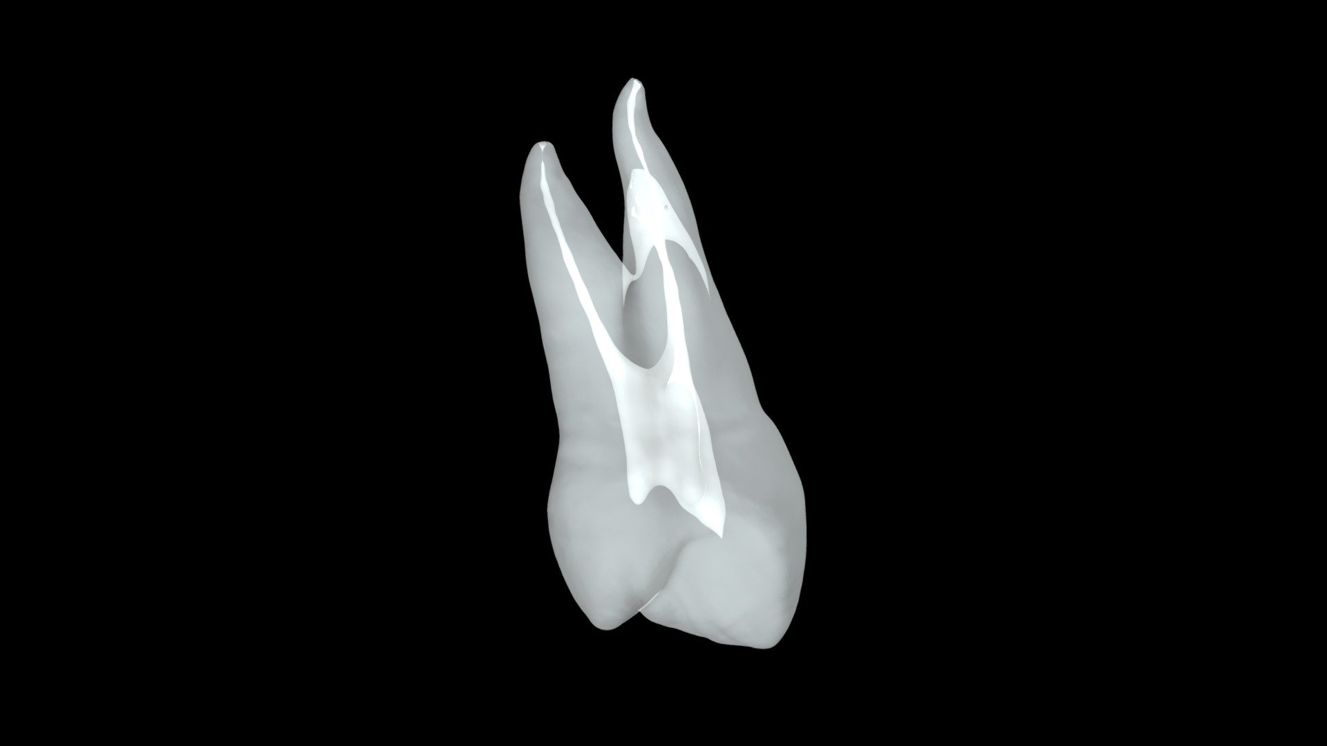 Tooth 12 Three Rooted - 3D model by biomed3d [5dc5fe5] - Sketchfab