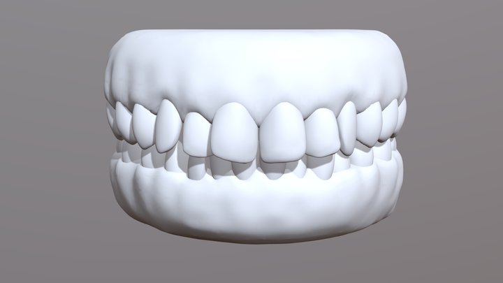 Teeth Movement Rotation Test 3D Model