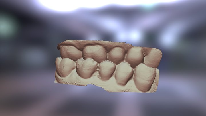 Bite Scan2 3D Model