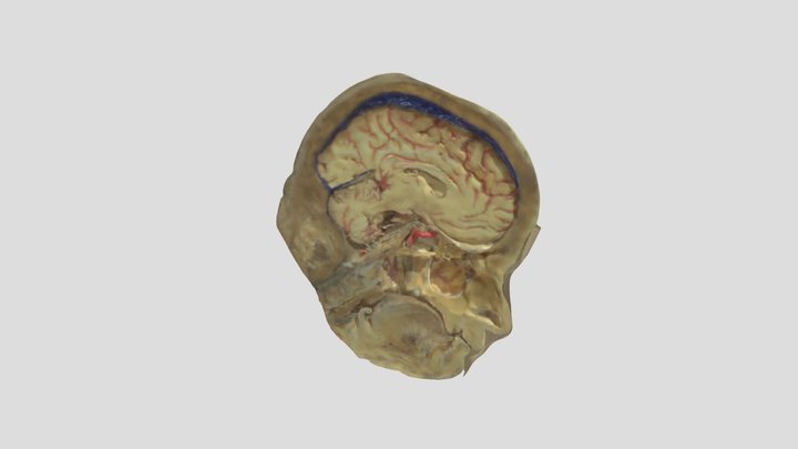 sag-cranial-nerves 3D Model